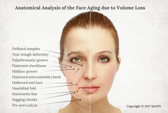 The anatomy of facial aging. Visual signs of age-related volume loss